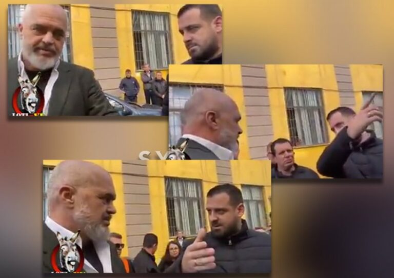 “Rama e ka frikë dorën, i duket sikur do e godasin”