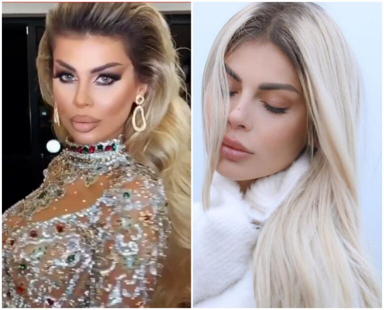 Larg grimit të rëndë televiziv, Luana duket ndryshe (FOTO)