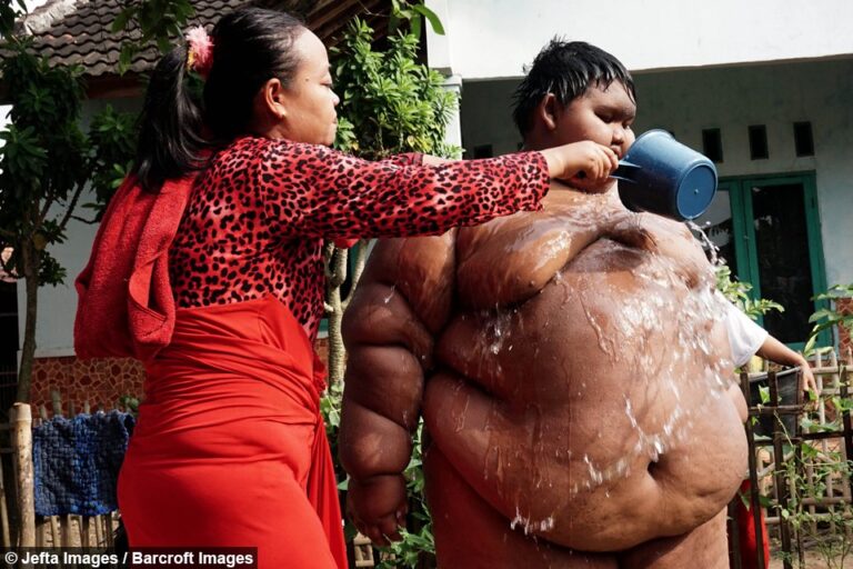Humbi 110 kg, nuk do ta besoni si duket fëmija më i shëndoshë në botë