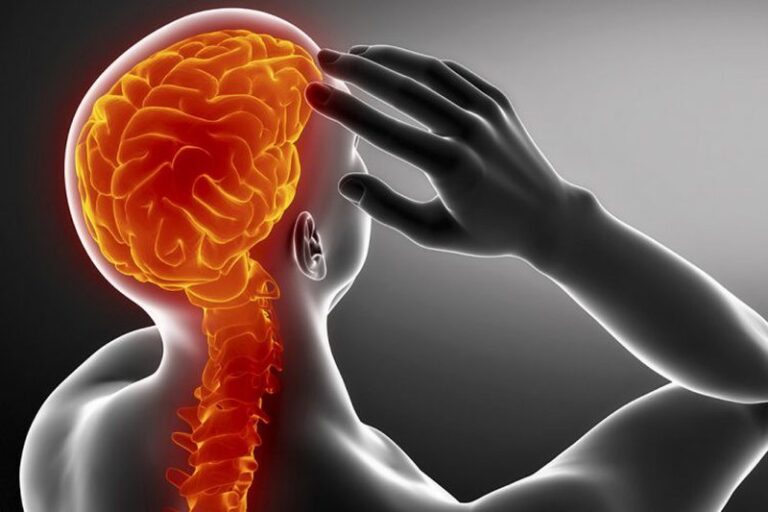 Çdo dhimbje koke sinjalizon një problem shëndetësor, zbuloni shenjat dhe çfarë duhet të bëni menjëherë