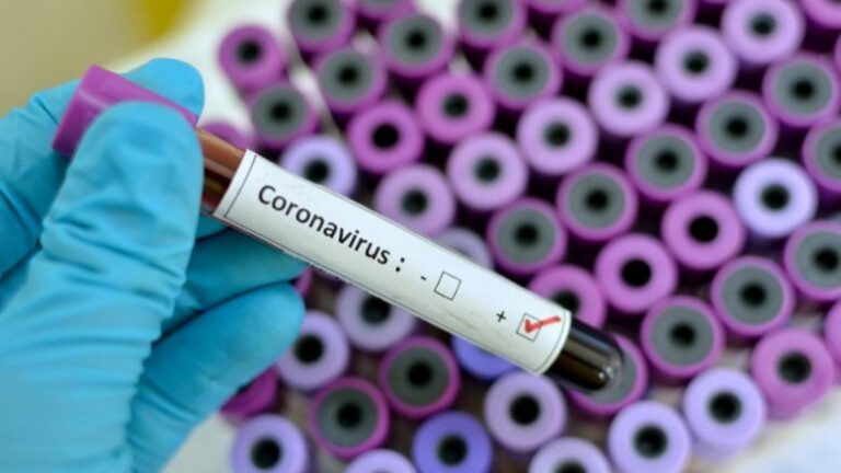 Turqia do të përdorë kitin diagnostikues që nxjerr rezultatin për COVID-19 për 15 minuta