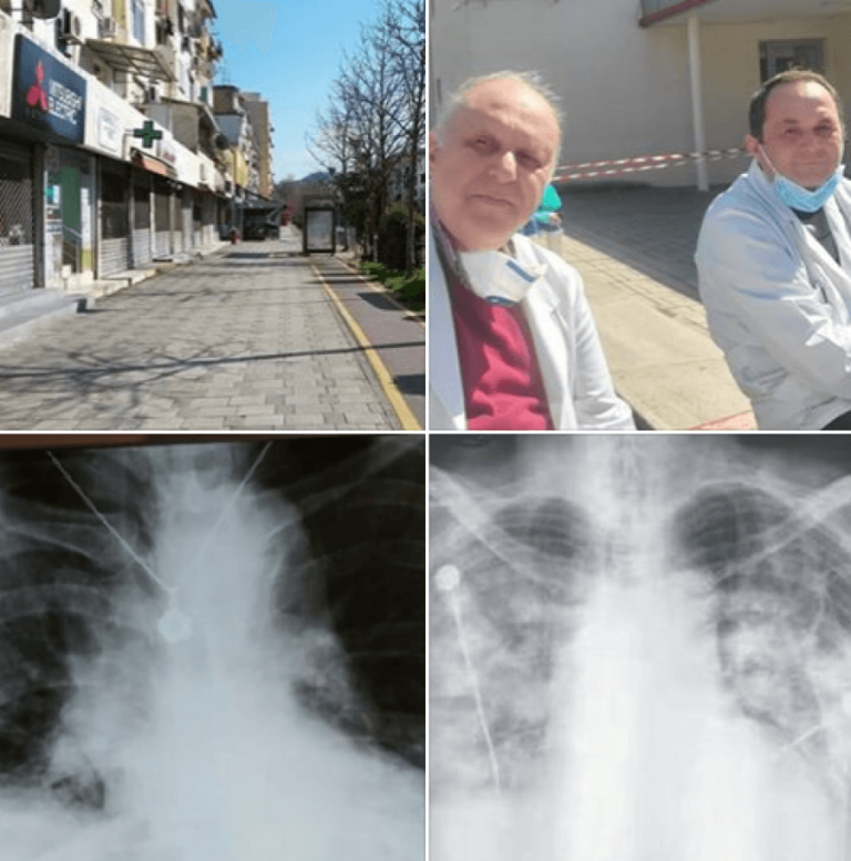 Mjeku i njohur: Ju lutem si prind, vetizolohuni që të mos ndodhë si në Itali