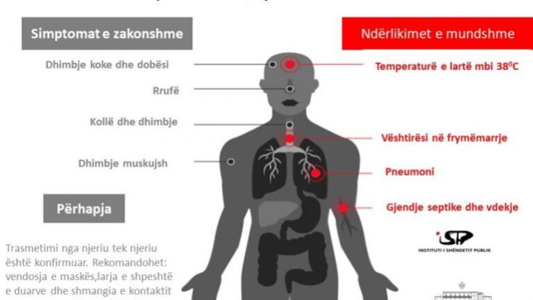 Instituti i Shëndetit Publik: Masat kryesore, si mund ta parandaloni prekjen nga koronavirusi