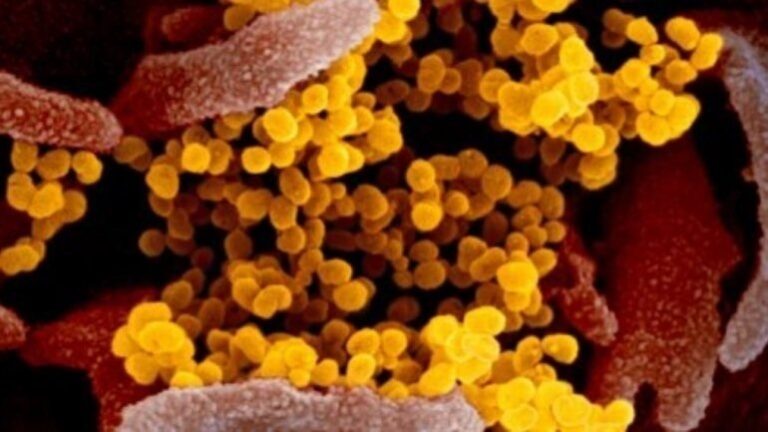 Ja si testohet një pacient për koronavirus