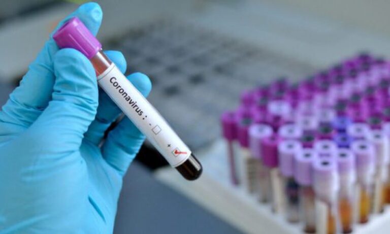 Infektohet me koronavirus kryeinfermierja e Pediatrisë