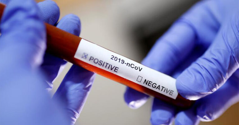Dy raste të reja me koronavirus në Kosovë, shkon në 63 numri i personave të prekur