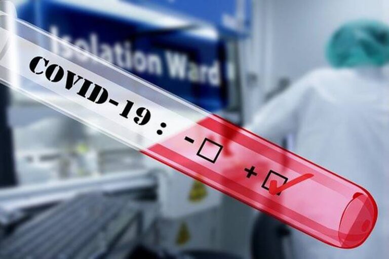 Identifikohen 2 raste të reja me koronavirus në Shkodër, kush janë të infektuarat
