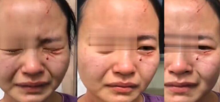 E ndaloi të largohej nga karantina spitalore, pacienti kafshon infermieren dhe e dhunon mizorisht (VIDEO)