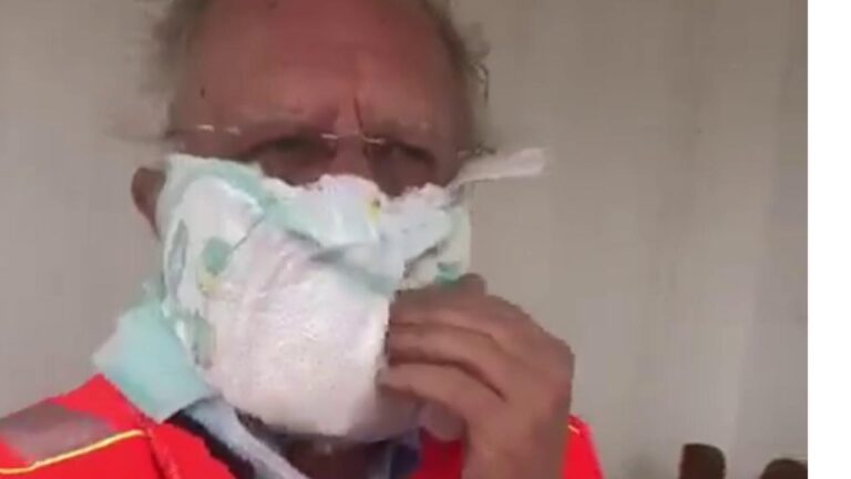 Mjeku italian vë si maskë mbrojtëse një pelenë bebesh, ia surgjeron të gjithëve