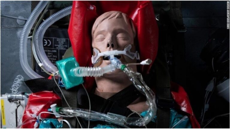 “Pandemia mund të na shkatërrojë!” Ky është shteti me 12 milionë banorë dhe vetëm 4 respiratorë