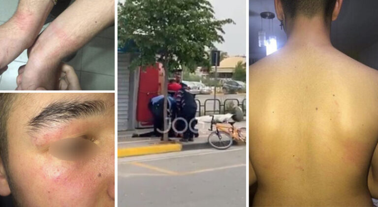 Dhunë barbare ndaj të miturit, pezullohet polici