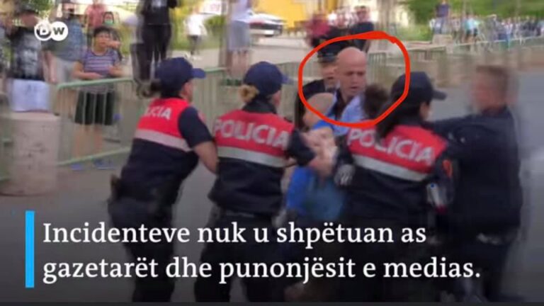 Gazetari denoncon me emër “shefin” që dhunoi Alfred Lelën: Policët, si laca lagjesh duke u rrahur me grushta!