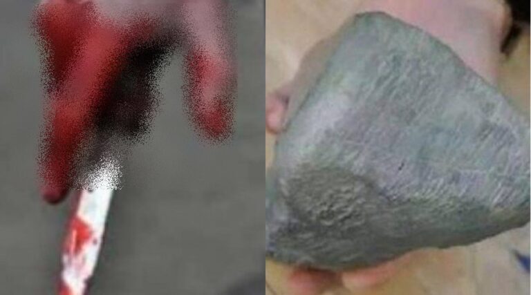 Detajet nga sherri, nipi e goditi me gur në kokë dhe të shoqit i nguli thikën në gjoks