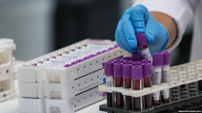 Licencohen 18 laboratorë të tjerë për kryerje të testeve serologjike në Kosovë