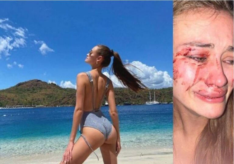 Modelja e njohur dhunohet nga rojet e sigurimit në Izmir