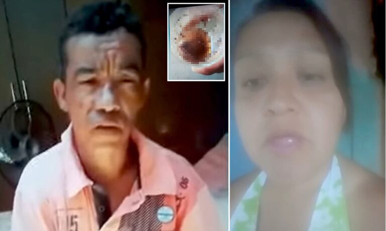 Gruaja këput me dhëmbë testikujt e burrit që donte ta përdhunonte