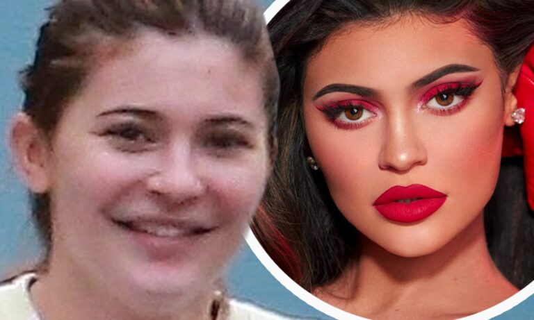 Kylie Jenner i rikthehet operacioneve plastike