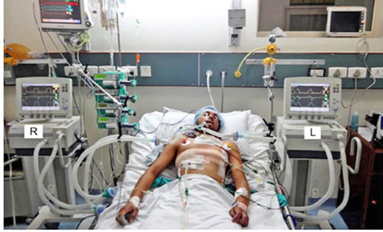 Tritan Shehu rrëfen rastin e pacientit të intubuar te “Shefqet Ndroqi”: Mjekët e shpëtuan, kjo tregon se…