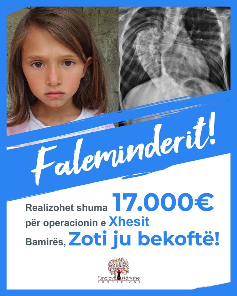 Rasti i 8-vjeçares që vuante nga skolioza, Arbër Hajdari jep lajmin e mirë për Xhesin