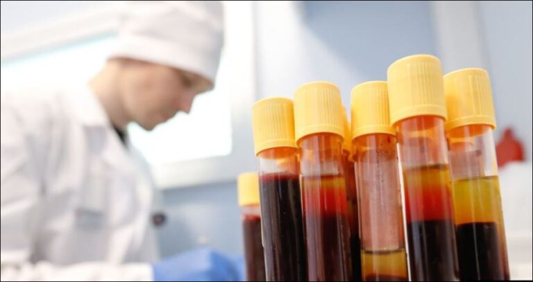 OBSH dhe ECDC: Shumë njerëz me HIV po diagnostifikohen vonë