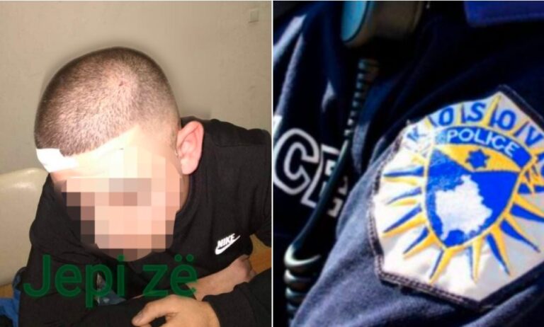 Nuk respektoi “orën policore”, polici përgjak 19-vjeçarin