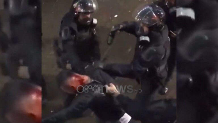 Qytetarët dënojnë dhunën policore ndaj protestuesve: Arrestimi i fëmijëve, kriminal