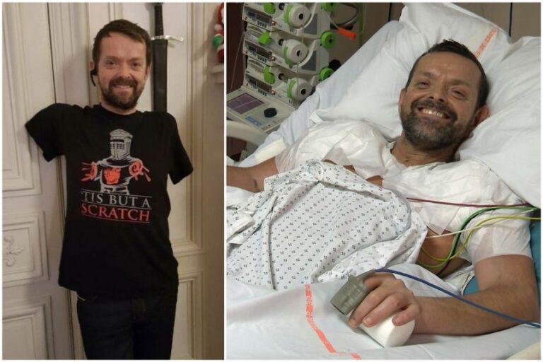Për herë të parë në botë, mjekët realizojnë transplantin e të dy krahëve