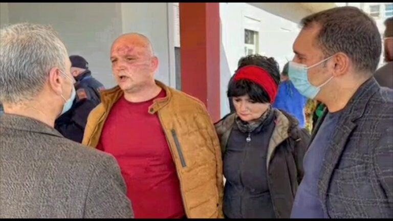 “Sulmohet me sende të forta në kokë Dorian Protoduari”, Këlliçi e viziton te Trauma: Ja si ndodhi ngjarja!