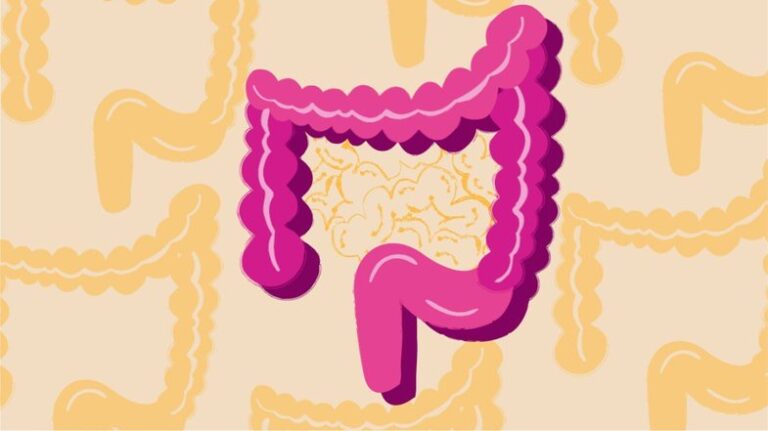 Shkaqet dhe simptomat: Ç’duhet të dini për sëmundjen Crohn
