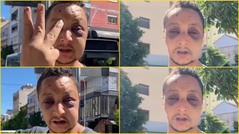 Akuza e të riut nga Maroku për dhunë/ Policia: Ai shiste kanabis, e rrahu një kamarier