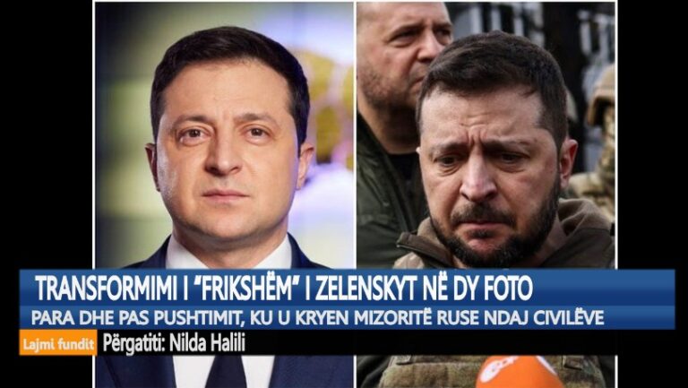 Transformimi i “frikshëm” i Zelenskyt në dy foto, para dhe pas pushtimit rus