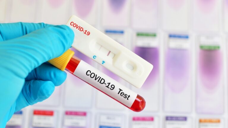 Infektimi me COVID-19 mund të rrisë rrezikun e diabetit të tipit 2 dhe sëmundjeve kardiovaskulare