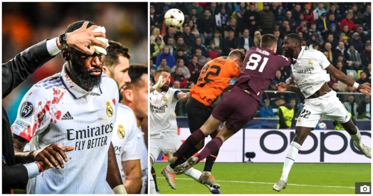 Goli i kushtoi 20 qepje Rudiger, por pritet të jetë në El Clasico