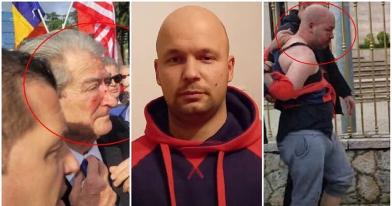 Burg për agresorin e Berishës, avokati: Ka dhënë deklarime të ndryshme
