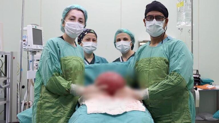 Iku në spital me dhimbje, mjekët i heqin gruas tumorin afro 4 kilogramë