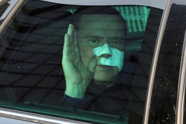 Nga zemra, menisku, Covid-i dhe operacionet plastike. Kalvari i gjatë i Berlusconit në dyert e spitaleve