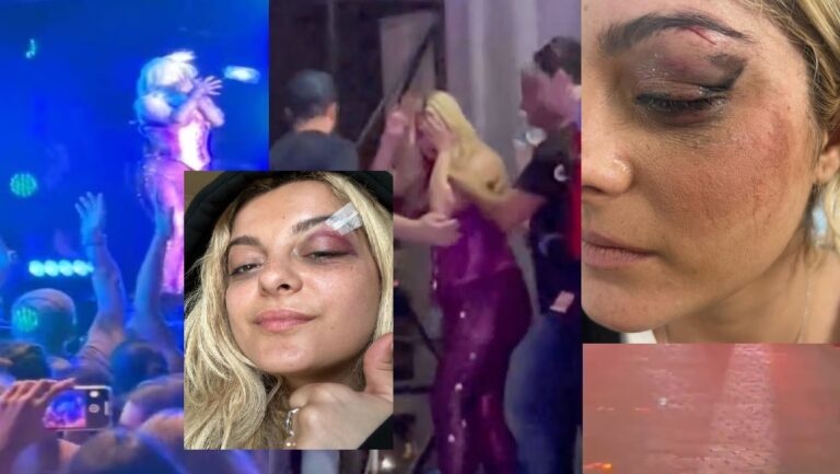 FOTO/ Bebe Rexha tregon pasojat e goditjes me telefon nga një person në koncert