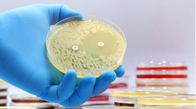 Shkencëtarët zbulojnë antibiotikët e parë duke përdorur Inteligjencën Artificiale