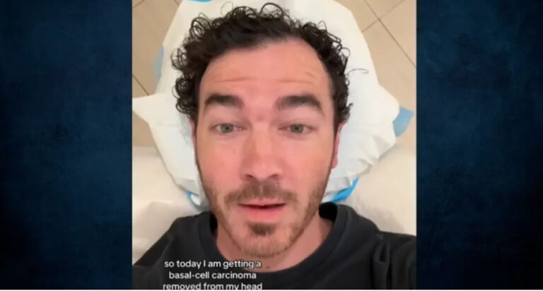Kevin Jonas zbulon se është diagnostikuar me kancer të lëkurës