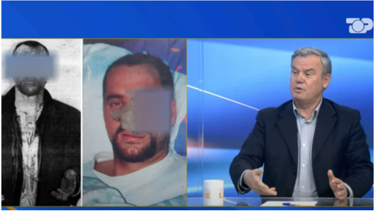 Dhuna barbare ndaj Ramës në vitin 1997. Nikoll Lesi në Top Channel: E gjetëm të shtrirë, të mbuluar me gjak! SHIK ishte autori…