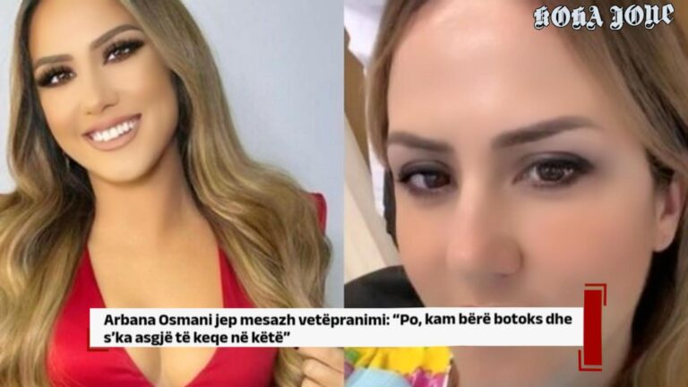 Arbana Osmani jep mesazh vetëpranimi: “Po, kam bërë botoks dhe s’ka asgjë të keqe në këtë”