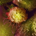 Paneli i ekspertëve këshillon kundër shqyrtimit të kancerit të prostatës për shumicën e burrave në Mbretërinë e Bashkuar