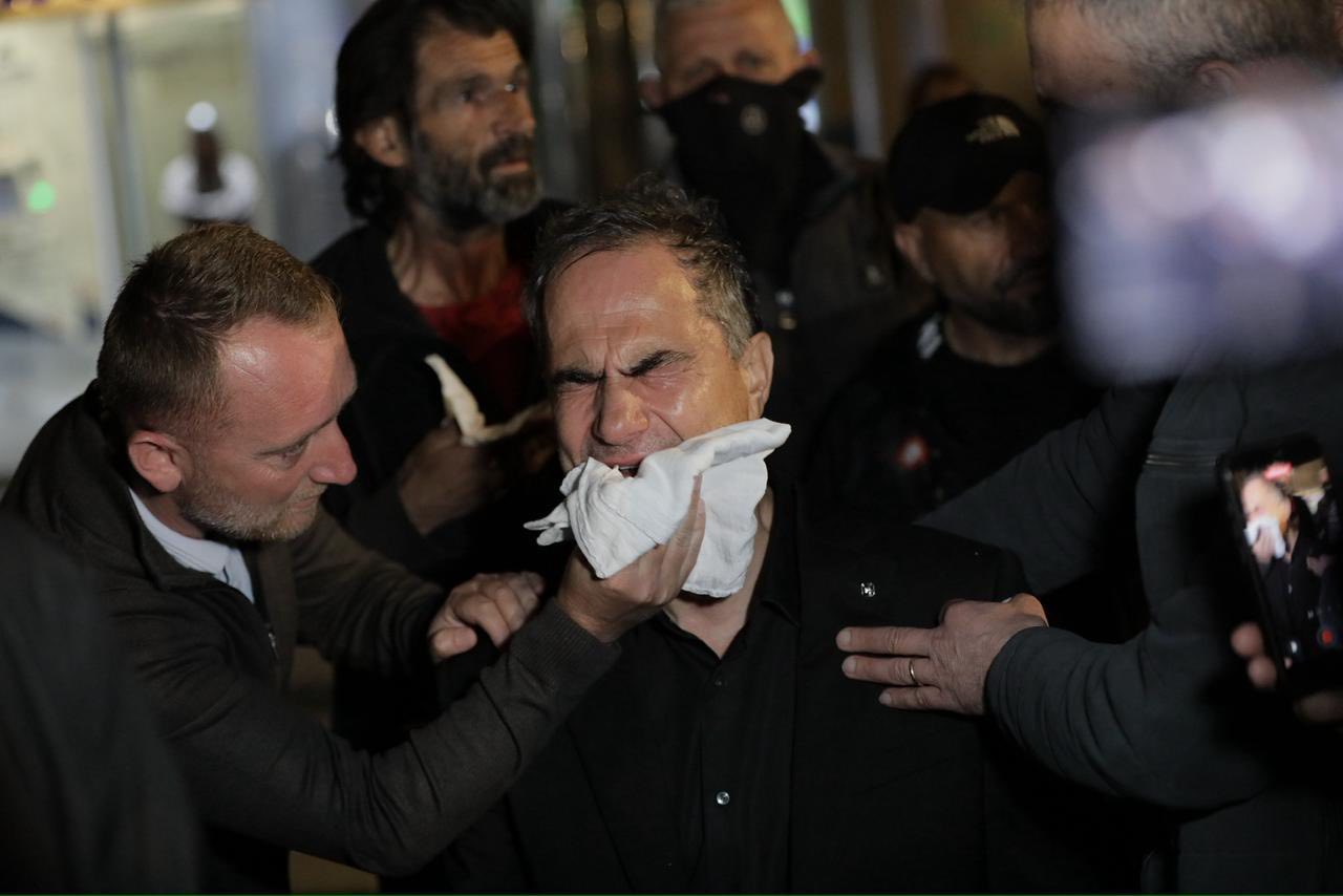 Berisha poston fotot e forta për tensionet në protestë  Sulme çnjerëzore
