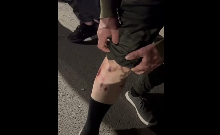 Berisha publikon Video: Akt kriminal! Hodhën granata ndaj protestuesve