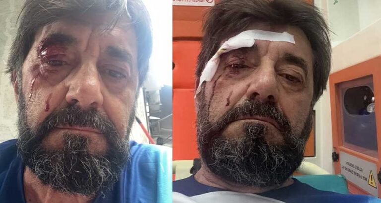 Sulmohet egërsisht analisti dhe publicisti i njohur Ilir Demalia: Këta janë cuba, në sy të policit bënë një dhunë të tillë