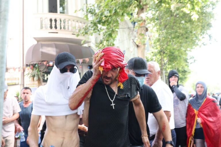 Protesta para Kuvendit/ 17 të lënduar në spitale, Ministria e Shëndetësisë: 6 policë dhe 11 protestues