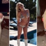 Britney Spears në shok pas trajtimit estetik: “Më shkatërruan fytyrën, mos u besoni!”