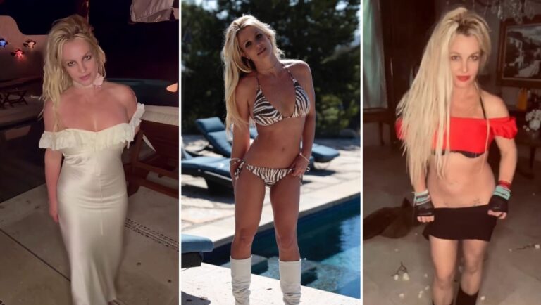 Britney Spears në shok pas trajtimit estetik: “Më shkatërruan fytyrën, mos u besoni!”