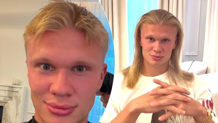 Erling Haaland surprizon me ndryshimin drastik në pamje, i jep lamtumirën flokëve të gjatë