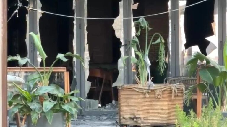 Pësoi djegie të rëndë pas zjarrit në hotelin në Vlorë, 25-vjeçarja niset për trajtim të specializuar në Turqi